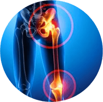 Chuyên khoa Cơ xương khớp