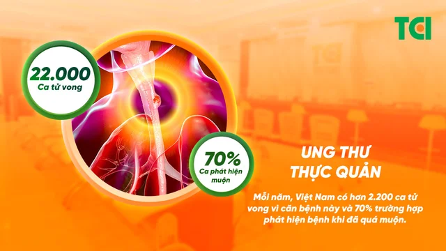Gói tầm soát ung thư Thực quản