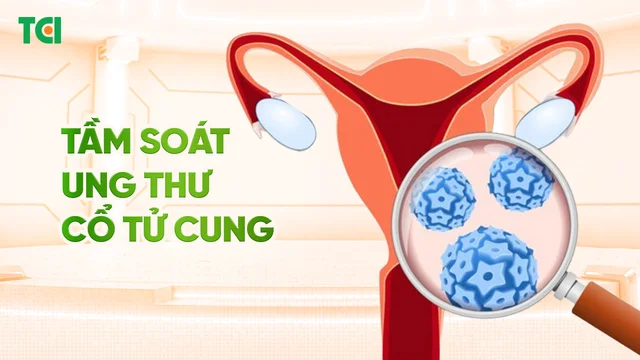 Gói tầm soát ung thư Cổ tử cung
