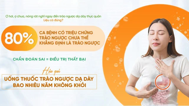 Điều trị trào ngược thực quản