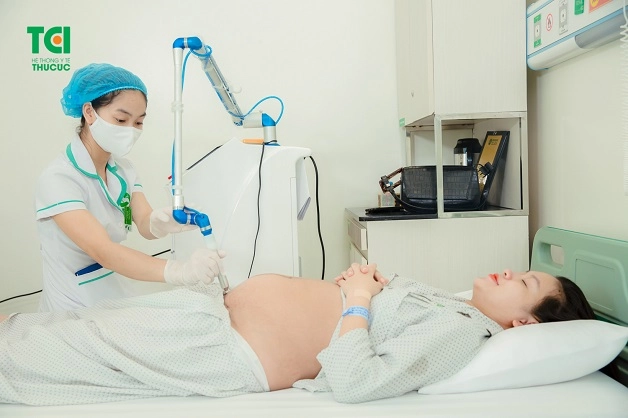 Công nghệ chiếu tia Plasma sau sinh giúp vết khâu nhanh lành, hạn chế để lại sẹo xấu