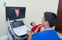 Siêu âm 5D là gì? Siêu âm 5D có chính xác không