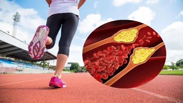 Các bài tập được khuyến cáo cho người bị mỡ máu cao