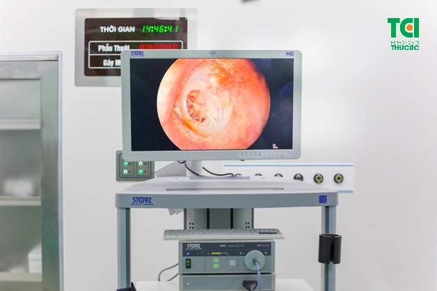 Dưới sự hỗ trợ của máy móc hiện đại, toàn bộ chi tiết hình ảnh của vùng tai mũi họng sẽ hiển thị rõ ràng, giúp bác sĩ chẩn đoán chính xác.
