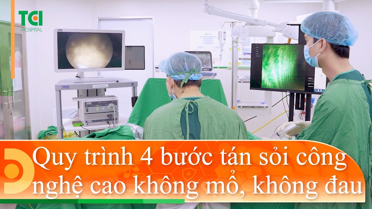 Khám phá quy trình 4 bước tán sỏi
