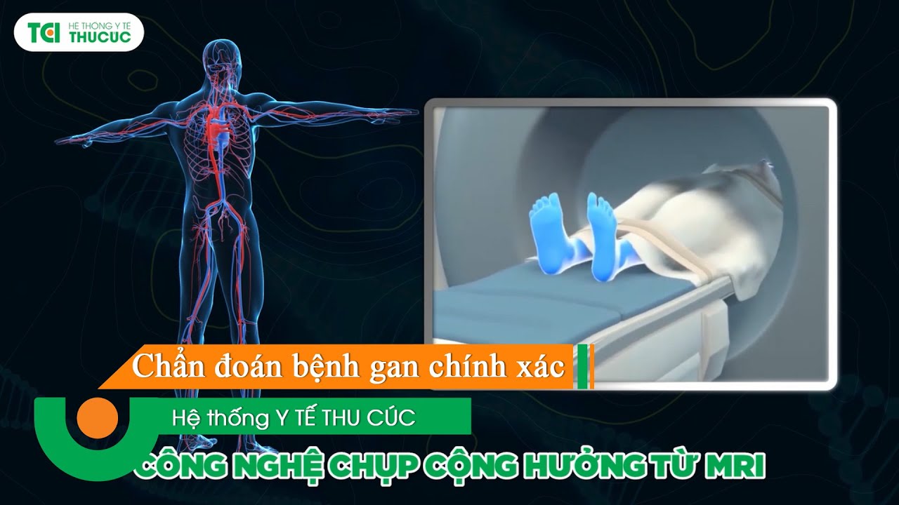 Chẩn đoán bệnh gan chính xác bằng hệ thống thiết bị hiện đại tại TCI